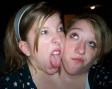 like this photo of Abigail and Brittany Hensel , as it shows so well ...